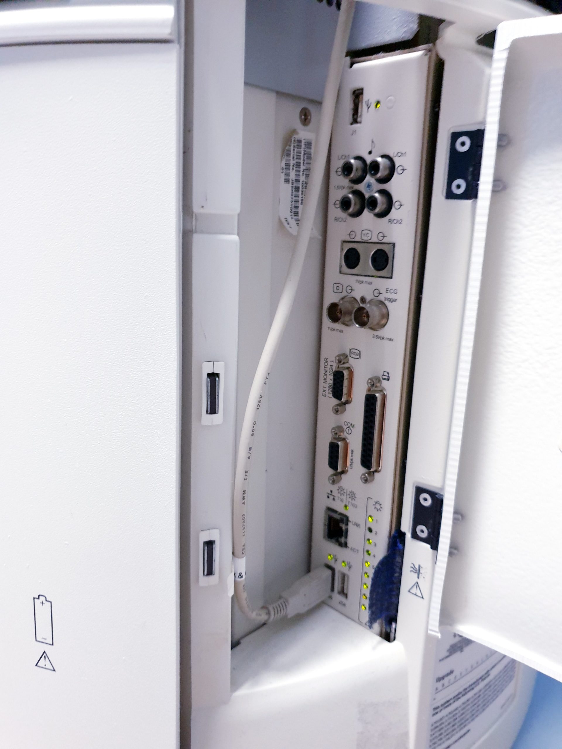 Siemens Acuson Antares Ultraschall Gerät mit 3 Sonden CH4-1 + PX4-1 + VFX9-4 – Bild 32