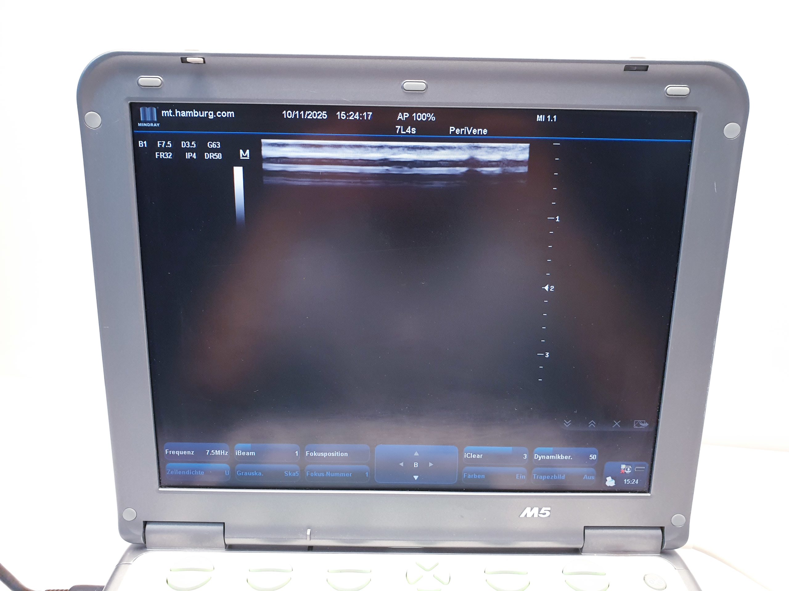 Mindray 7L4s Linear Ultrasound Transducer – Bild 10