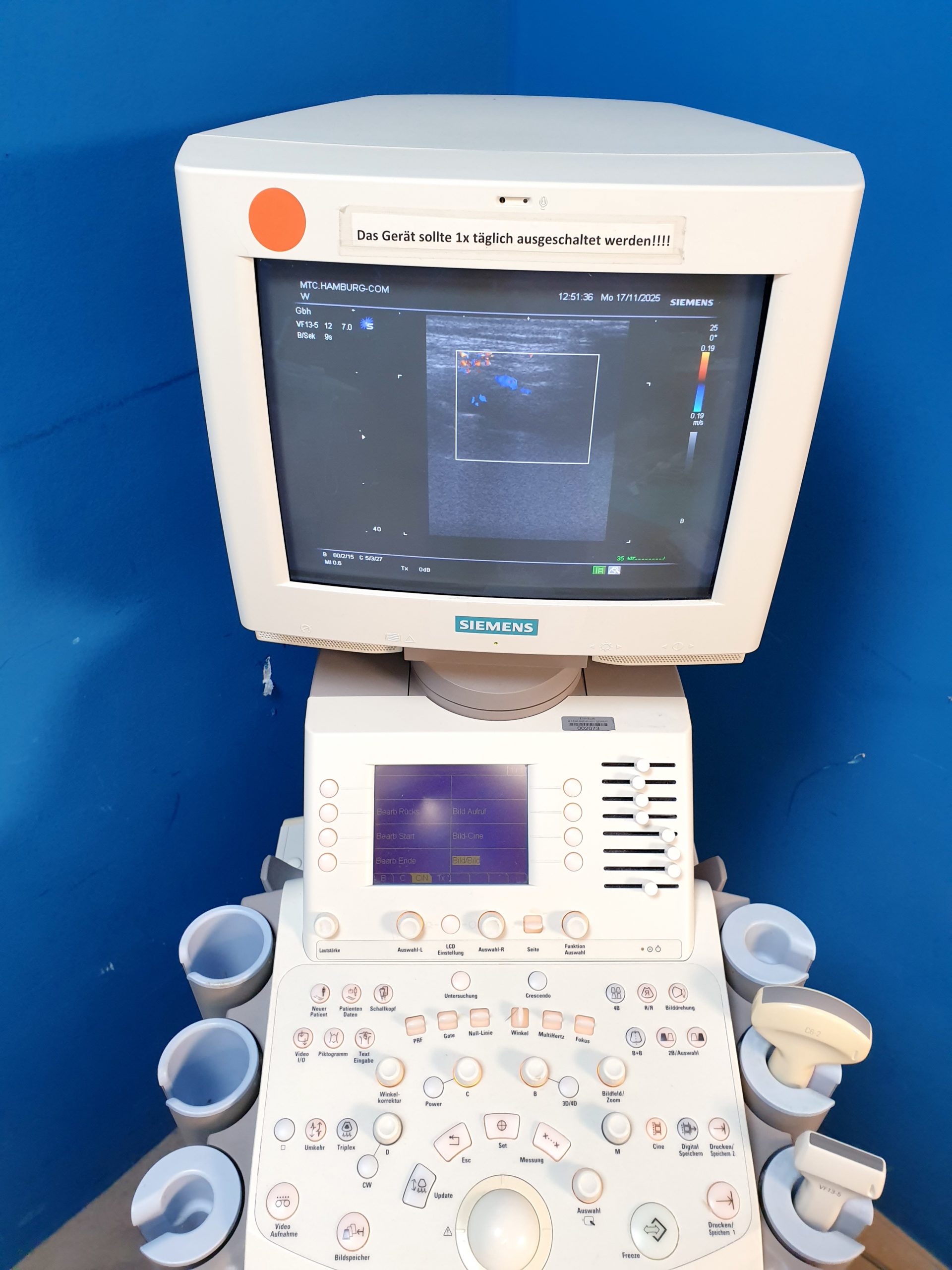 Siemens SONOLINE G60S Ultraschallgerät mit Sonden VF13-5 + C6-2 – Bild 3