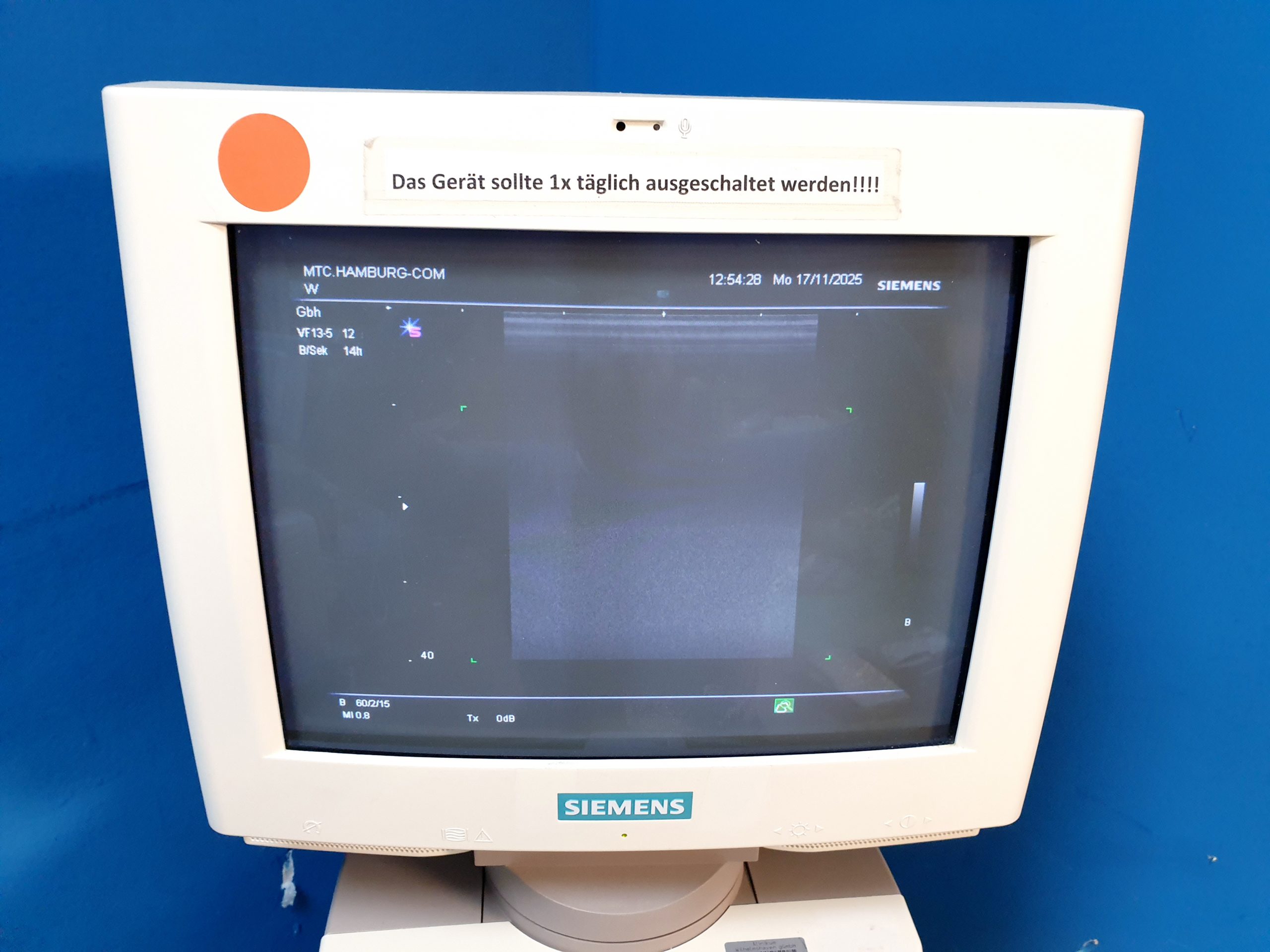 Siemens SONOLINE G60S Ultraschallgerät mit Sonden VF13-5 + C6-2 – Bild 6