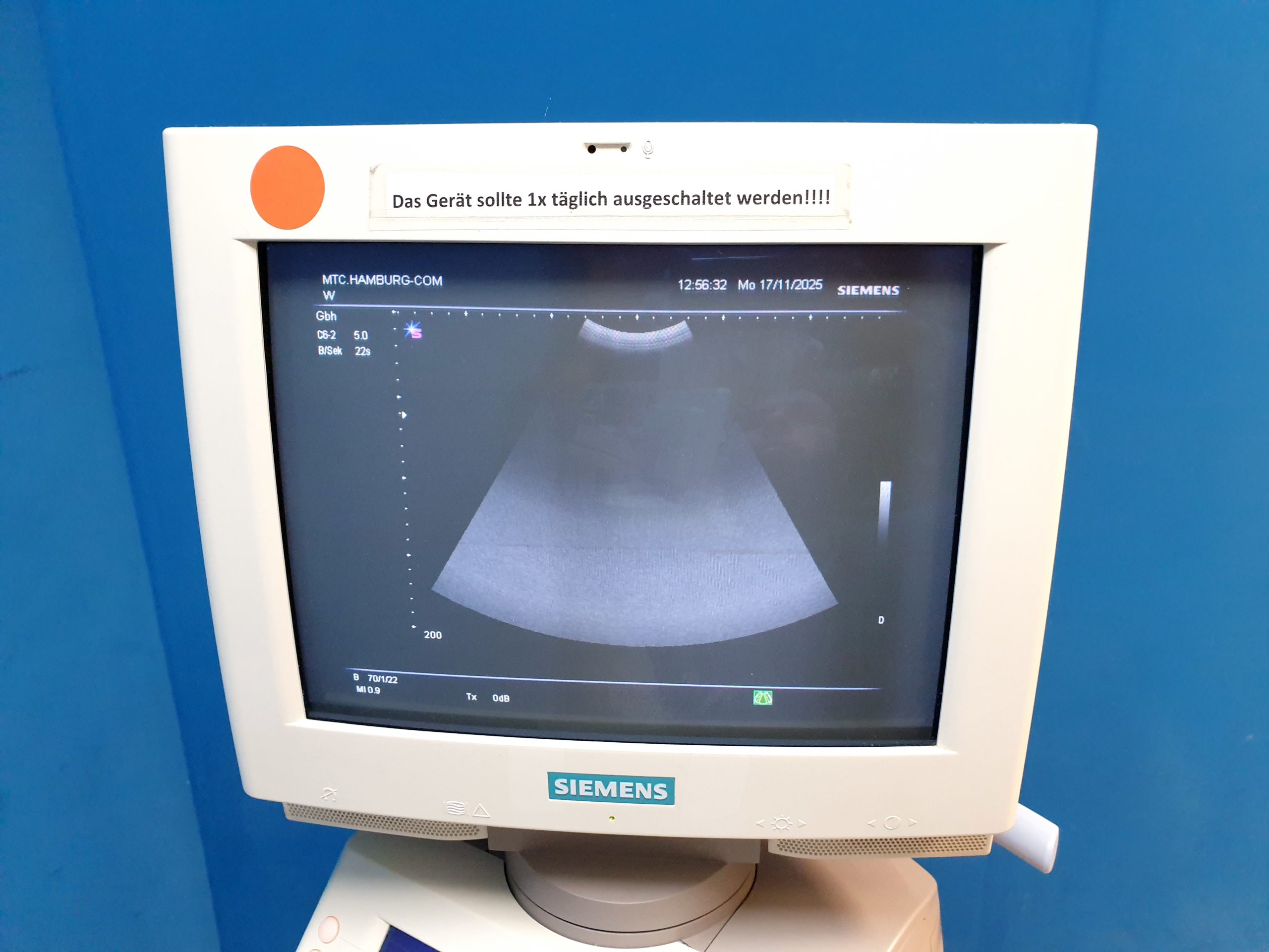 Siemens SONOLINE G60S Ultraschallgerät mit Sonden VF13-5 + C6-2 – Bild 10