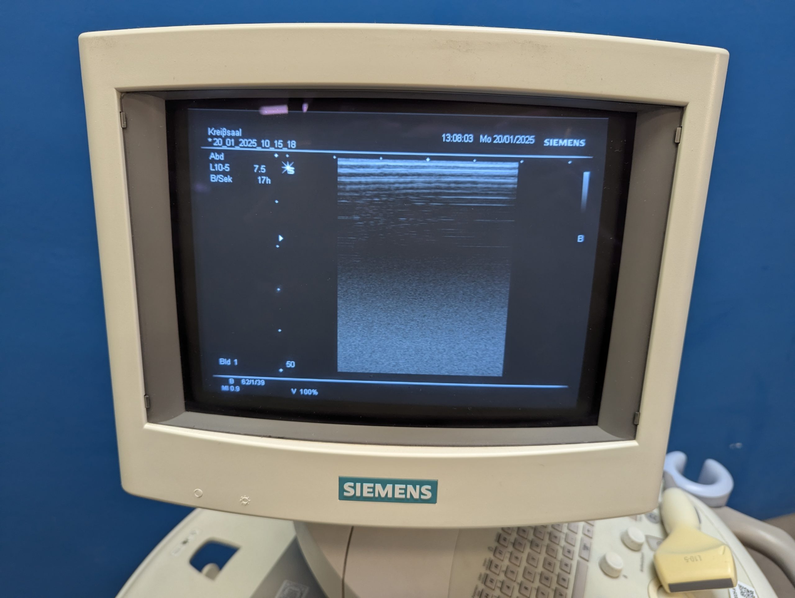 Siemens L10-5 Schallgerät – Bild 12