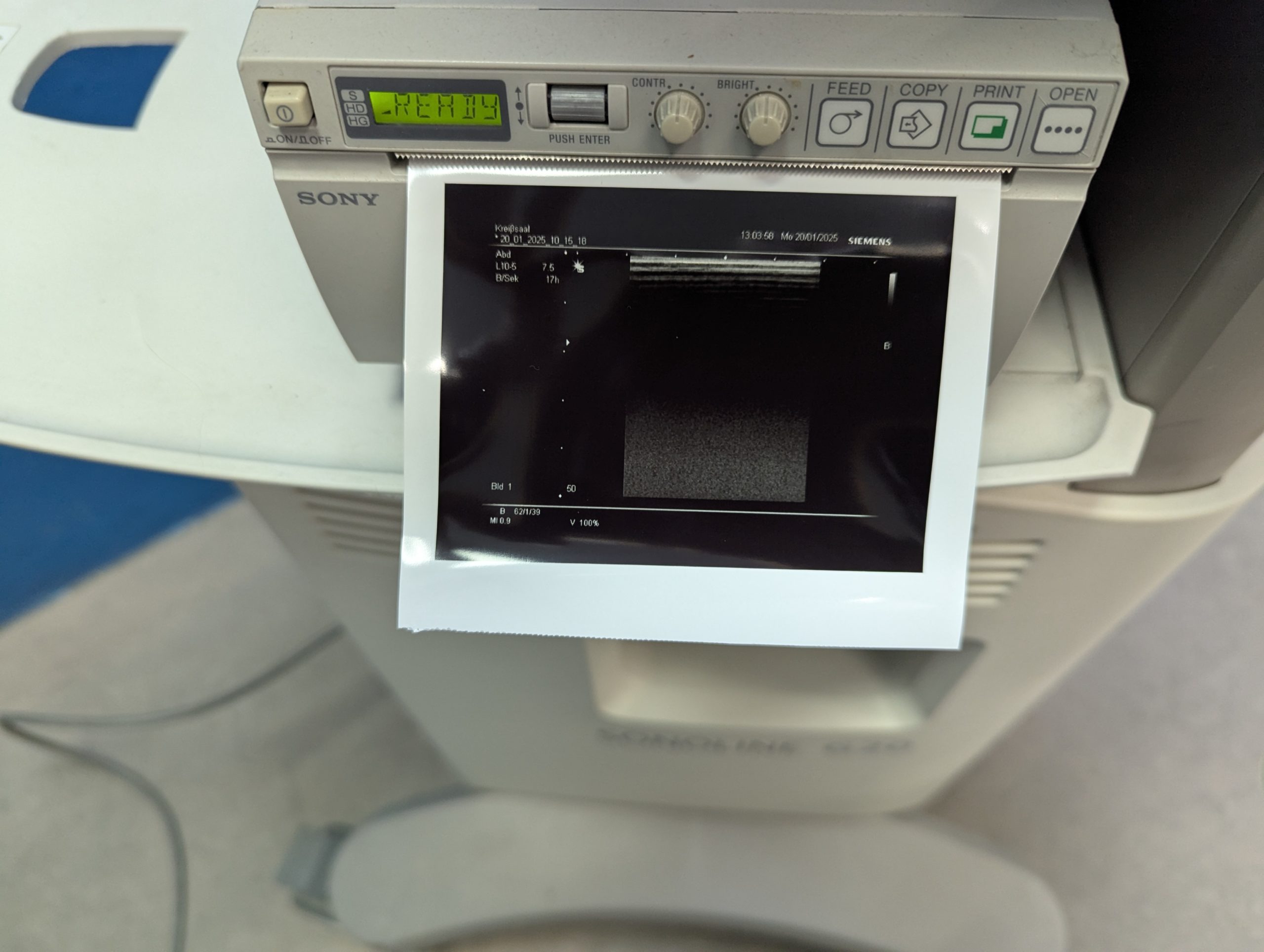 Siemens L10-5 Schallgerät – Bild 13