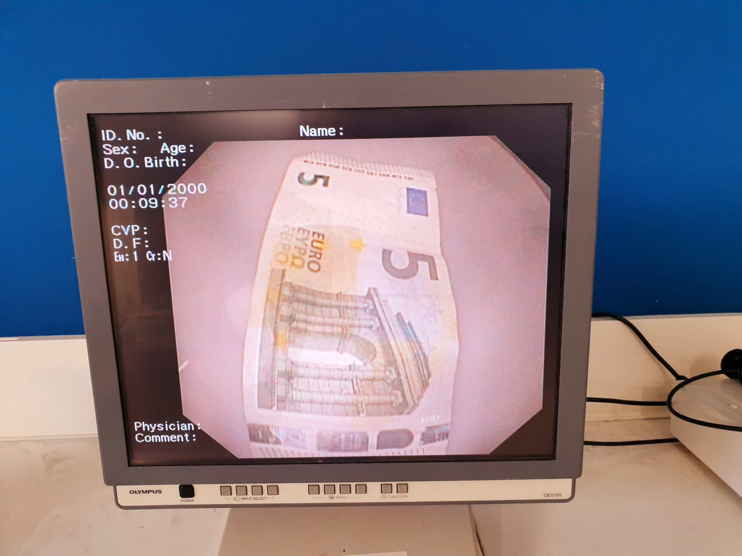 Olympus CV-160 + CLV-160 Video Endoscopy System – Bild 5