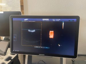 Samsung V4-8 4D Konvexsonde 3D/4D Volumensonde