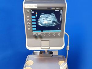 Sonosite s-Nerve Ultraschallgerät + C60x Ultraschallsonde