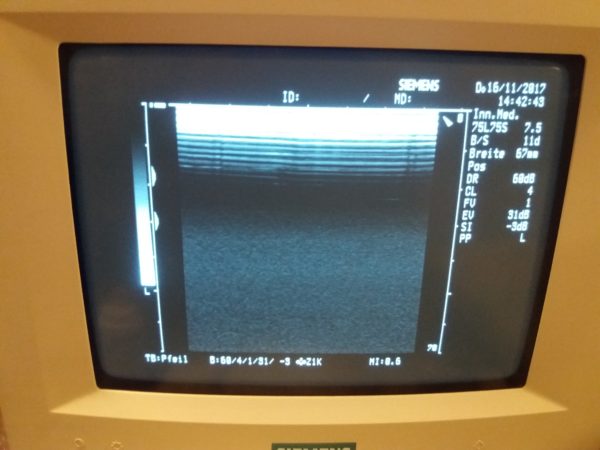 Siemens 7.5L75S  Linear Sonde   7.5MHz