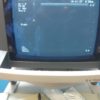 BK Medical 2101 Falcon Ultrasound mit Konvex, Linear und Printer