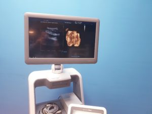 Samsung Sonoace ACCUVIX A30 // A 30 3D/4D V4-8 3D Sonde  L7-16IS UND ES4-9IS   DOM 2013