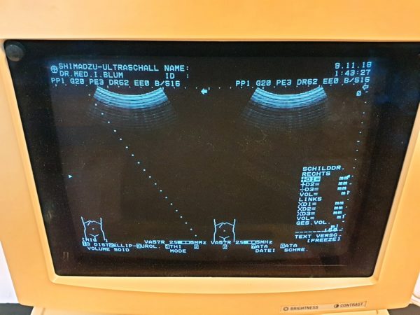 SHIMADZU SDU-450XL VA57R-0375U Konvex und L070-075U linear vascular 60mm transducer ( 5-7.5mhz )