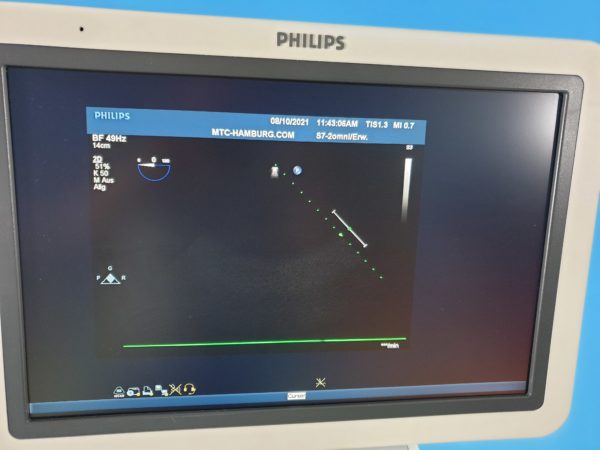 Philips S7-2 Omni TEE-Sonde Transesophageal Echocardiography Probe