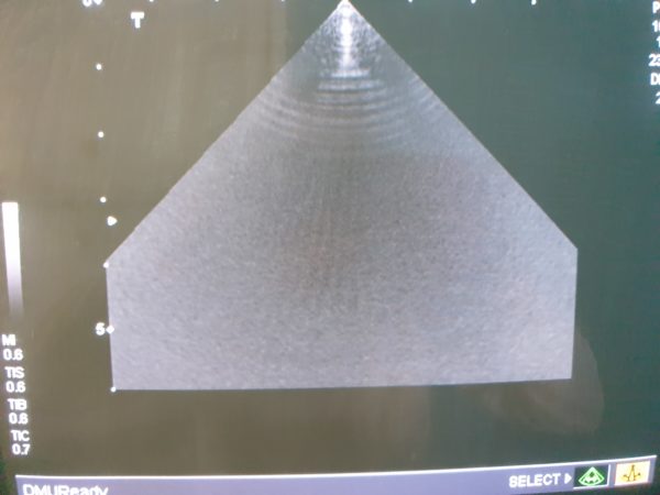 Toshiba PSM-70AT  // PSM 70 AT  Phased Array Ultrasound Probe