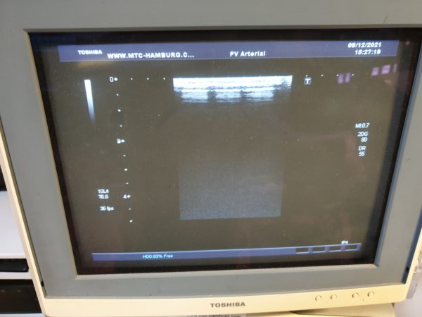 Toshiba PLT-604AT 9.2-4Mhz  Linear