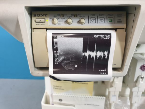 GE Logiq 400 Pro Farbdoppler mit Konvex und Endovaginal