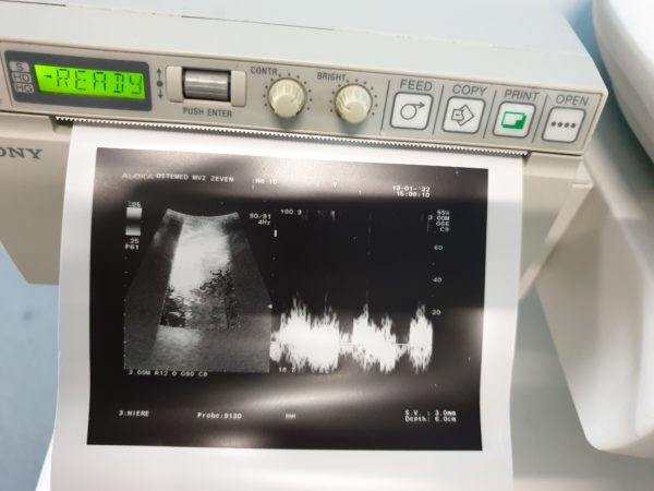 Aloka Prosound Alfa 10 Farbdoppler mit Konvex, Linear und Printer ,