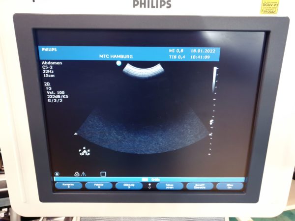 Philips C5-2 Konvex Sonde