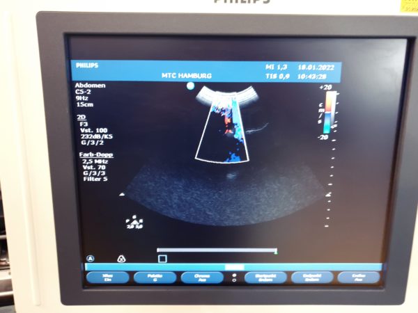 Philips C5-2 Konvex Sonde
