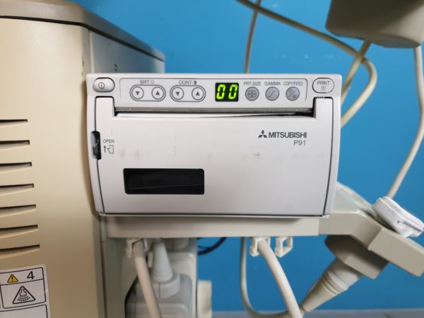 ALOKA SSD-1000 // SSD1000  Ultraschallgerät mit Konvex, Linear und Printer