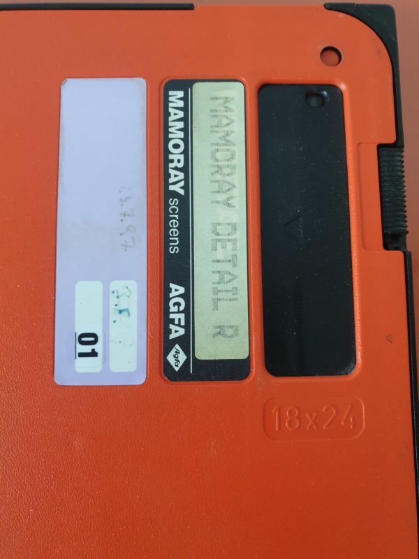 Agfa Memory screens  Details R  18X24