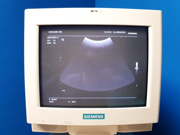 Siemens G50 // G 50  MIT C5-2 Konvex +  7.5L70 Linear   + BE09-4  Endovaginal + Printer - Farbdoppler