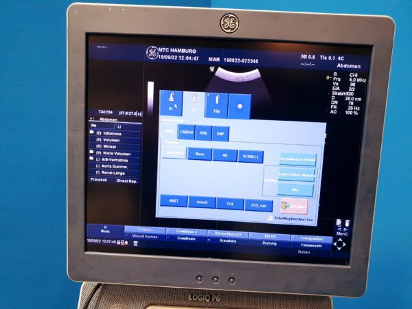 GE Logiq P6 BT11 View   mit 3Sp Echosonde und 9L Linear Sonde und Konvex 4C   DOM 2009