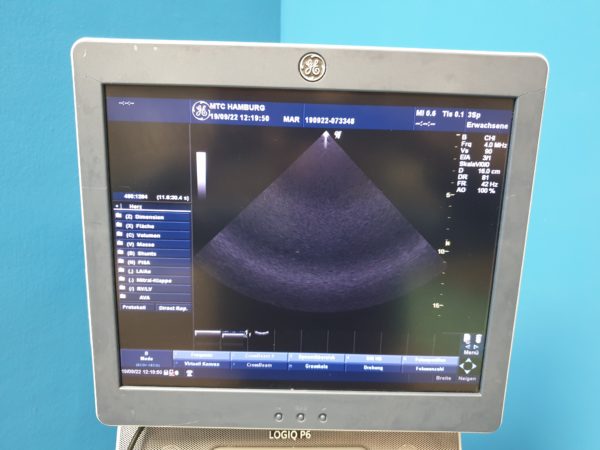 GE Logiq P6 BT11 View   mit 3Sp Echosonde und 9L Linear Sonde und Konvex 4C   DOM 2009