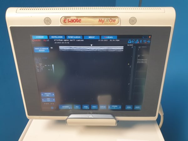 Esaote MyLab One Doppler Mod. 8100 mit Konvex und Linear + Printer  // DOM 2011