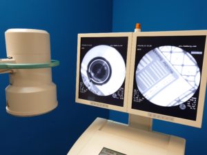 ZIEHM Vision C Bogen  Mobiles Röntgen  C ARM