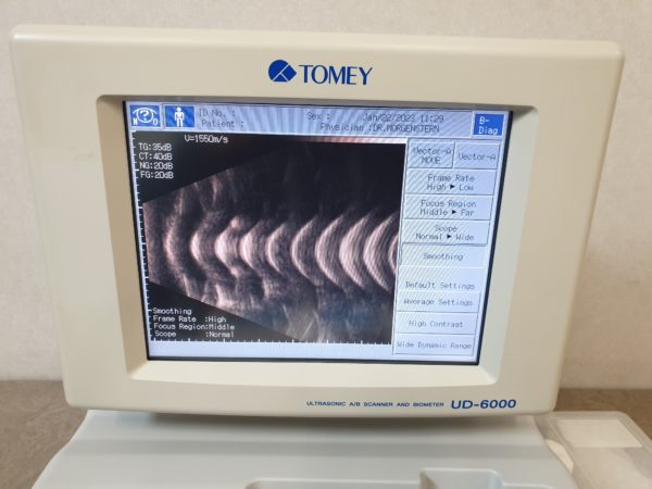 TOMEY  UD-6000 Ultrasound Ultrasonic AB Scanner and Biometer
