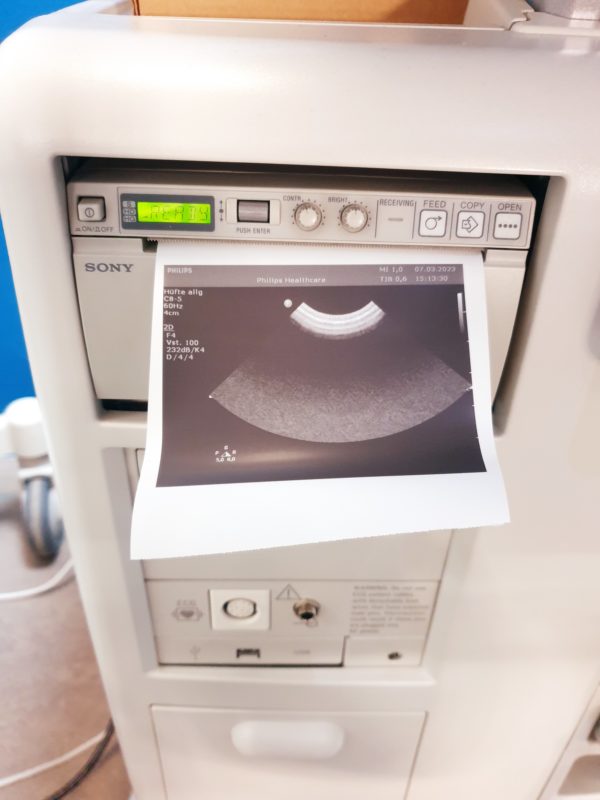Philips C8-5 Mikrokonvex Sonde - Ultraschallsonde