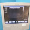 SIEMENS Acuson X300 // X 300 , CH5-2+ VF8  + 3 P4-2 Doppler , ...