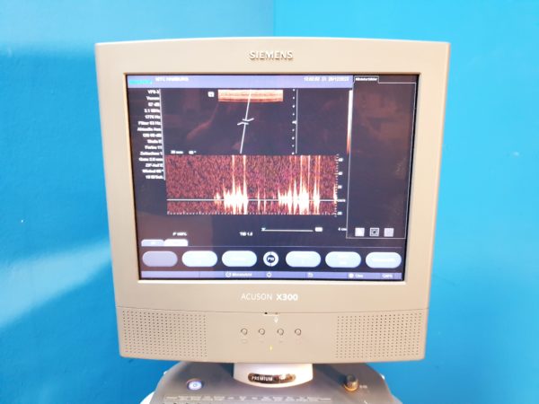 Siemens Acuson X300 // X 300  Premium Edition - Kardiomaschine