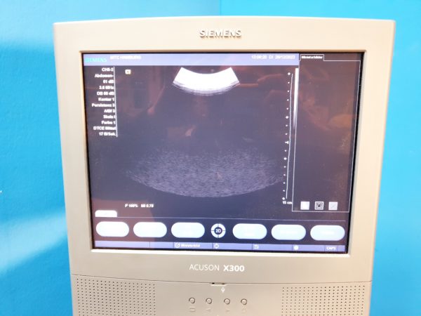 Siemens Acuson X300 // X 300  Premium Edition - Kardiomaschine