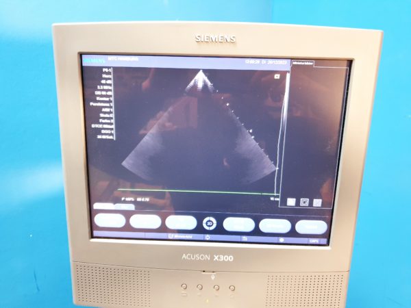 Siemens Acuson X300 // X 300  Premium Edition - Kardiomaschine