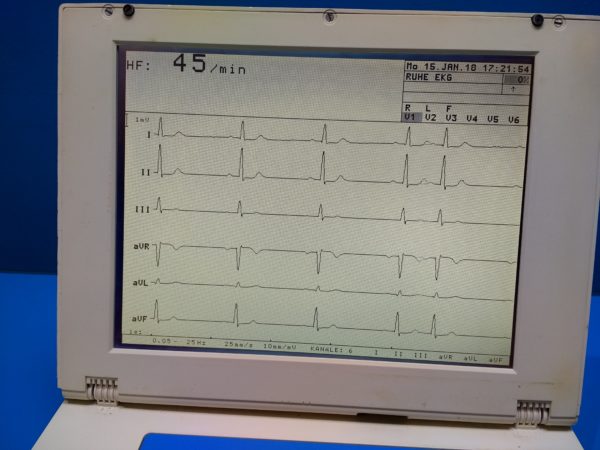 Schiller Cardiovit AT-5 // AT5 // AT 5 EKG Gerät