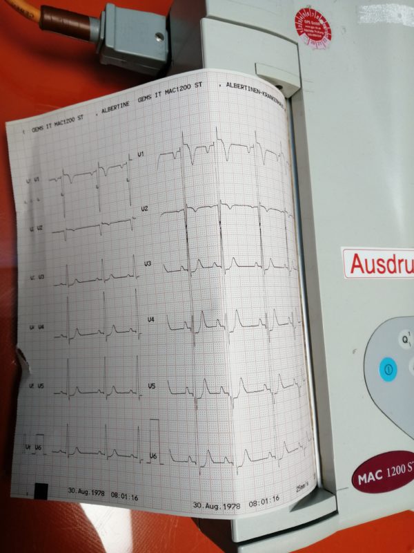 GE MAC 1200ST  EKG Gerät