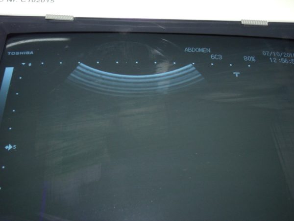 TOSHIBA PVQ-375A Ultrasound Transducer