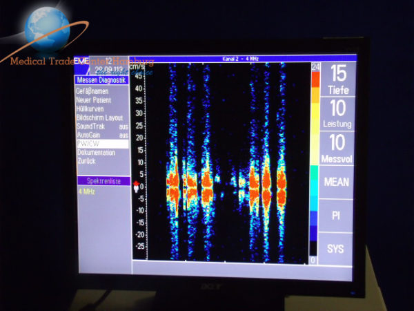 NICOLET Pioneer TC2020 Doppler Waveform Analyzer